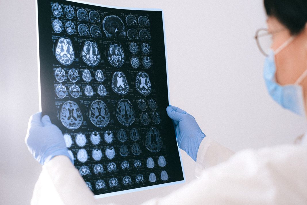 neuroscienze cervello – Come funziona la memoria umana