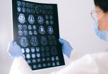 Come funziona la memoria umana: tipi, meccanismi e come migliorarla neuroscienze cervello – Come funziona la memoria umana