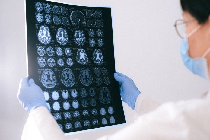 Immagine in evidenza – Come funziona la memoria umana neuroscienze cervello – Come funziona la memoria umana